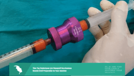 Yüze yağ enjeksiyonu için nanograft hazırlanması