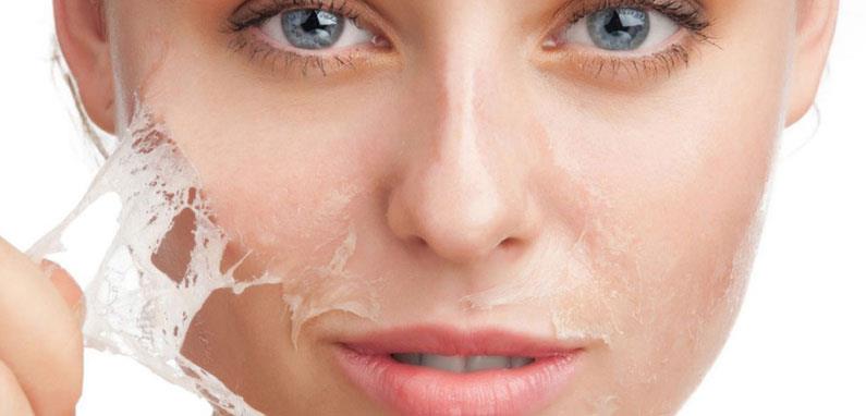 Adana Kimyasal Peeling